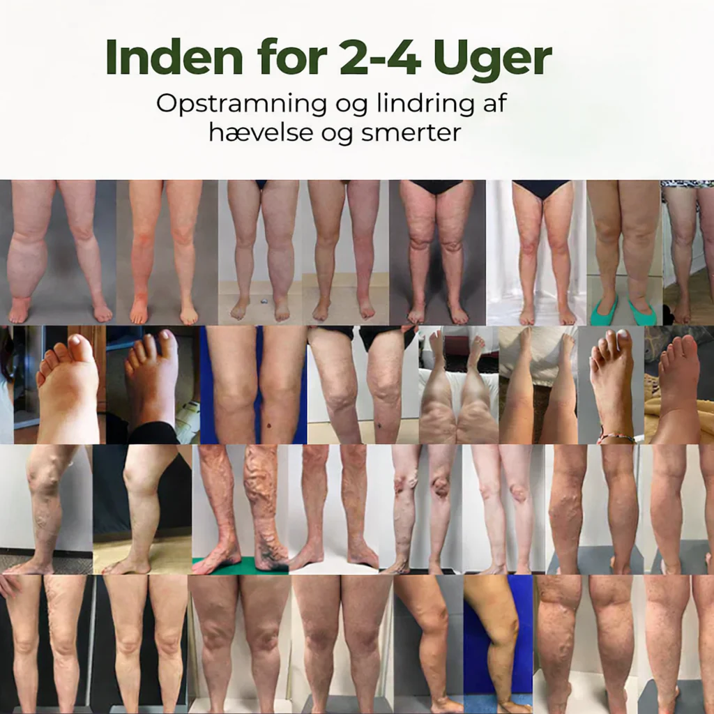 Produktbillede 2