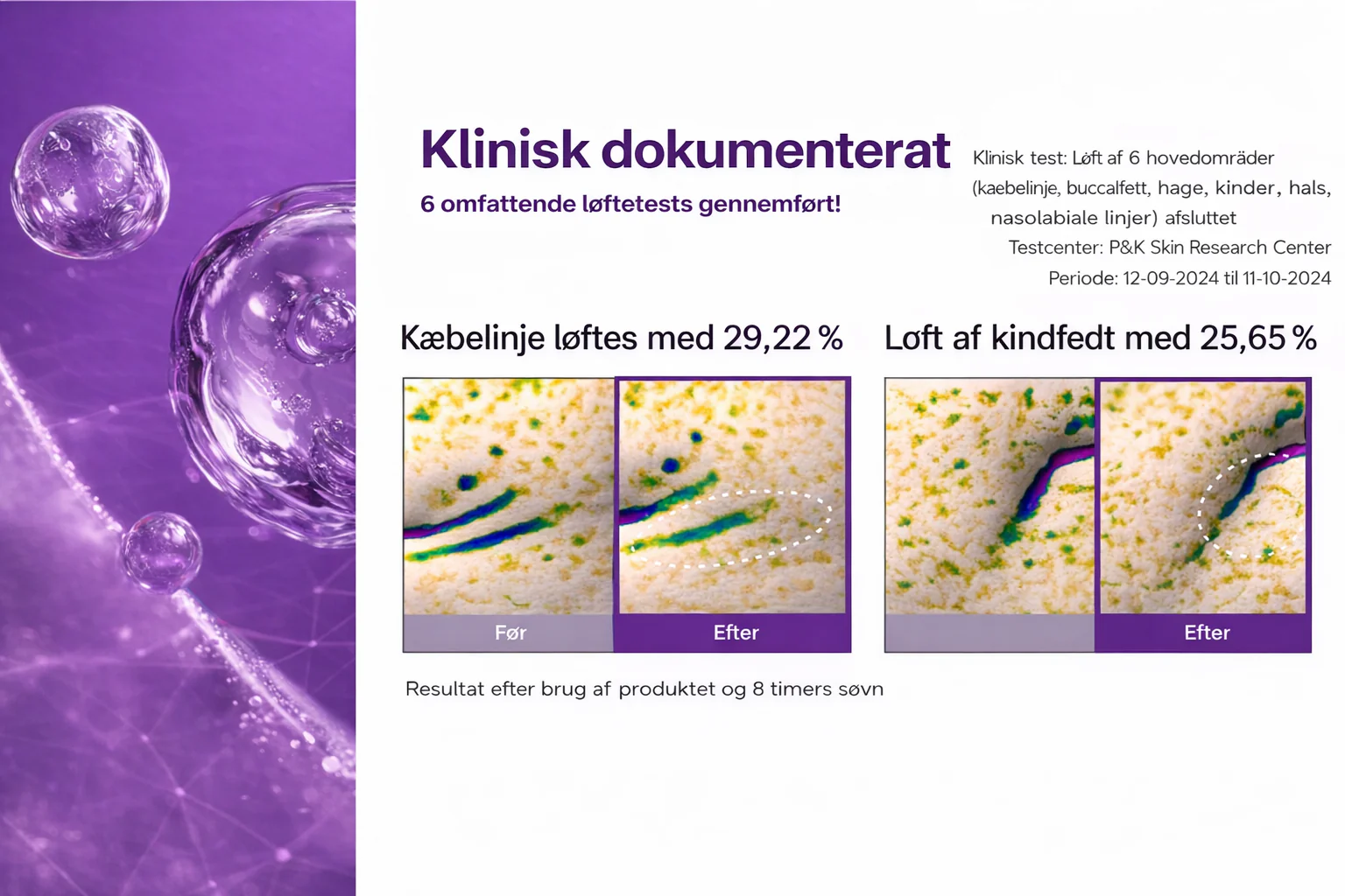 Produktbillede 11