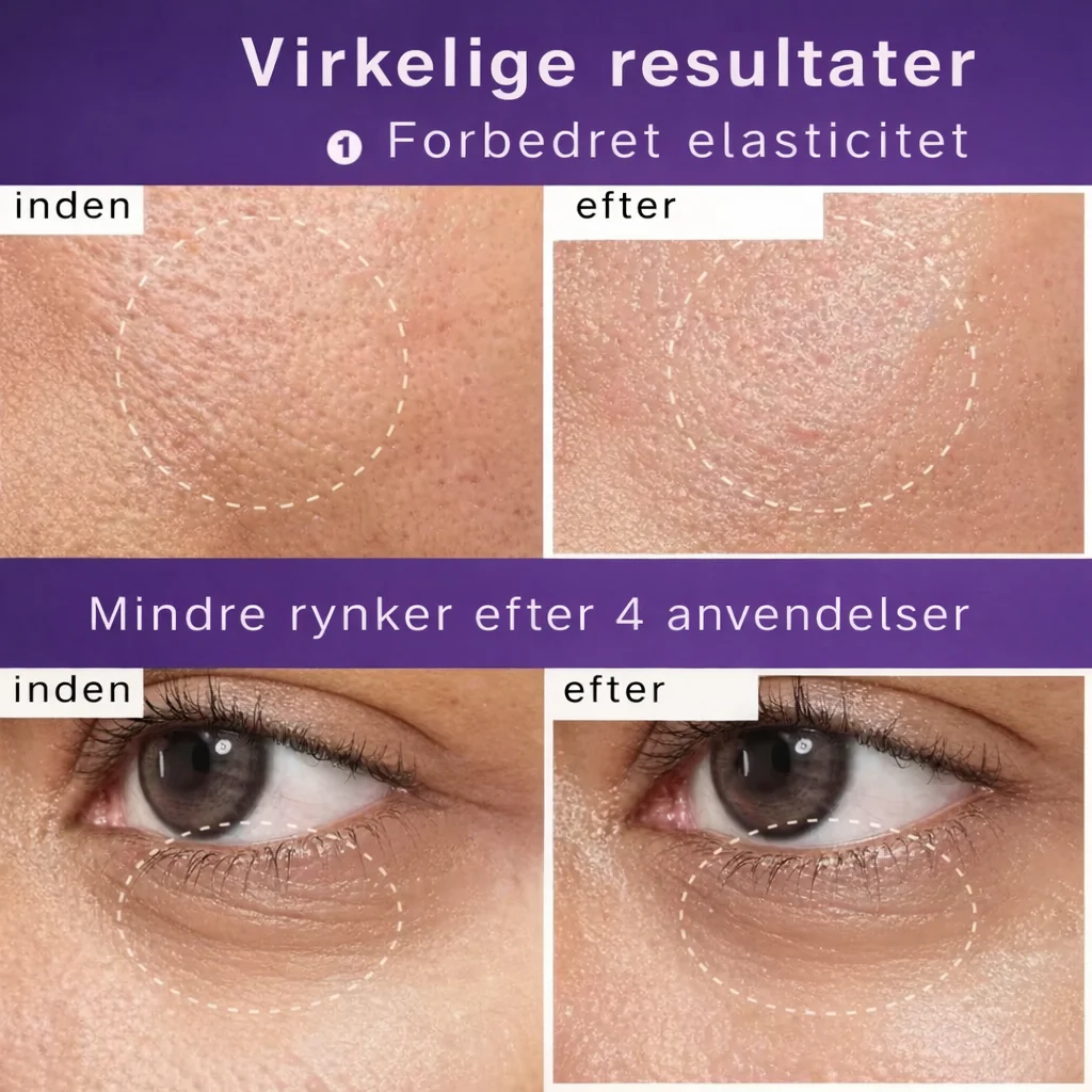 Produktbillede 14