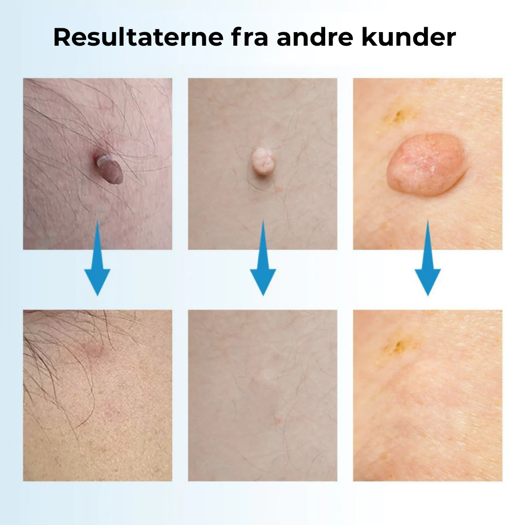Produktbillede 4