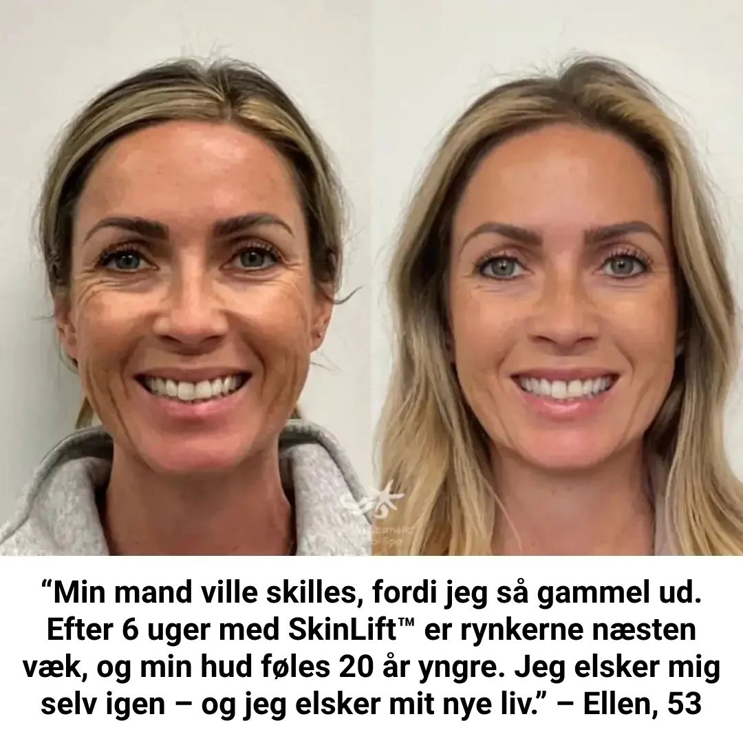 Produktbillede 11