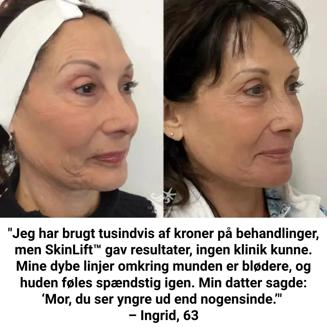 Produktbillede 7